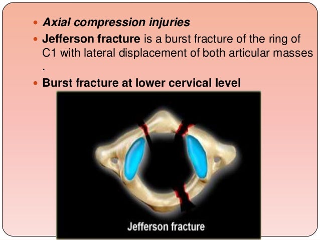Biomechanics Of The Cervical Spine Ppt 3 