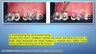 ORTHOBiomechanics of tooth-movement.pptx