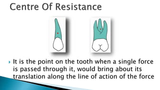  It is the point on the tooth when a single force
is passed through it, would bring about its
translation along the line of action of the force
 