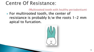  For multirooted tooth, the center of
resistance is probably b/w the roots 1-2 mm
apical to furcation.
19
 