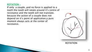 32
ROTATION –
If only a couple ,and no force is applied to a
tooth the tooth will rotate around it’s centre of
resistance and the tooth will not translate.
because the action of a couple does not
depend on it’s point of application,a pure
moment always acts at the center of
resistance.
ROTATION
 