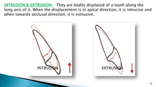 34
EXTRUSIONINTRUSION
INTRUSION & EXTRUSION- They are bodily displaced of a tooth along the
long axis of it. When the displacement is in apical direction, it is intrusive and
when towards occlusal direction, it is extrusive.
 