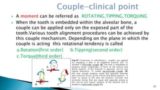  A moment can be referred as ROTATING,TIPPING,TORQUING
 When the tooth is embedded within the alveolar bone, a
couple can be applied only on the exposed part of the
tooth.Various tooth alignment procedures can be achieved by
this couple mechanism. Depending on the plane in which the
couple is acting this rotational tendency is called
a.Rotation{first order} b.Tipping{second order}
c.Torque{third order}
37
 