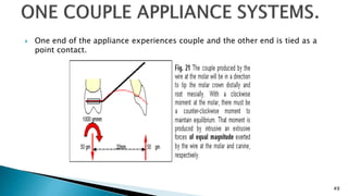  One end of the appliance experiences couple and the other end is tied as a
point contact.
49
 
