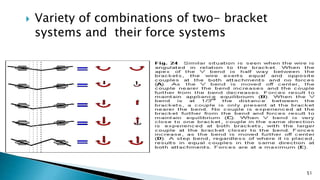 Variety of combinations of two- bracket
systems and their force systems
51
 
