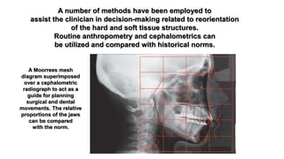 Biomechanics and treatment of dentofacial deformities part 1 | PPTX