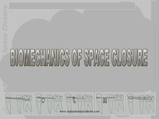 BiomechanicsofSpaceClosure
www.indiandentalacademy.com
 