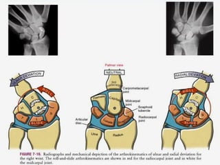 biomechanics of wrist joint and hand complex | PPT