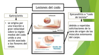 Lesiones del codo
Epitrocleitis
• se origina por
una tracción a
gran velocidad
sobre la región
medial del codo
unido a una
acción asociada
a los flexores del
carpo.
Epicondilitis o “codo
de tenista”
debido a repetidas
solicitaciones de la
zona de origen de los
músculos extensores
del carpo.
 