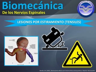 Biomecánica
Nordin, M. (2001). Biomecánica Básica del Sistema Musculoesquelético. Madrid: McGrawHIll.
De los Nervios Espinales
LESIONES POR ESTIRAMIENTO (TENSILES)
 