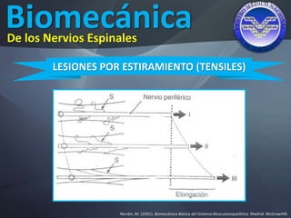 Biomecánica
Nordin, M. (2001). Biomecánica Básica del Sistema Musculoesquelético. Madrid: McGrawHIll.
De los Nervios Espinales
LESIONES POR ESTIRAMIENTO (TENSILES)
 