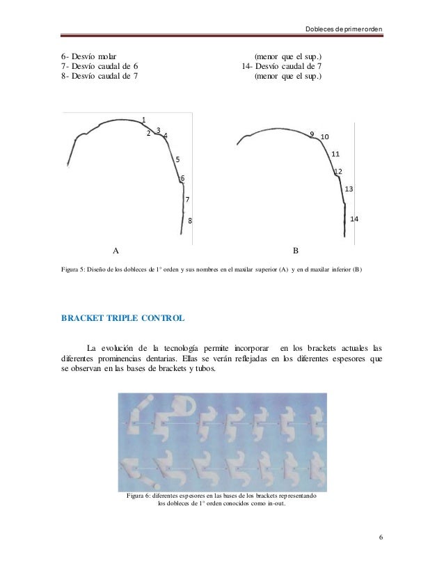 Biomecánica en ortodoncia
