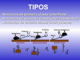 TIPOS
Alavancas de primeira classe (interfixas)
Alavancas de segunda classe (inter-resistentes)
Alavancas de terceira classe (inter-potente)
 