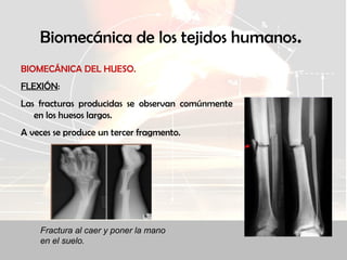 Biomecánica de los tejidos humanos.
BIOMECÁNICA DEL HUESO.
FLEXIÓN:
Las fracturas producidas se observan comúnmente
en los huesos largos.
A veces se produce un tercer fragmento.
Fractura al caer y poner la mano
en el suelo.
 