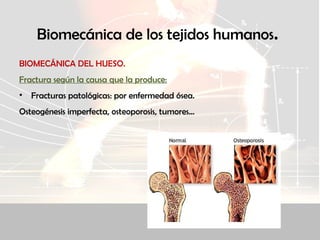 Biomecánica de los tejidos humanos.
BIOMECÁNICA DEL HUESO.
Fractura según la causa que la produce:
• Fracturas patológicas: por enfermedad ósea.
Osteogénesis imperfecta, osteoporosis, tumores...
 