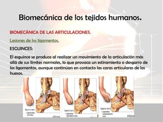 Biomecánica de los tejidos humanos.
BIOMECÁNICA DE LAS ARTICULACIONES.
Lesiones de los ligamentos.
ESGUINCES:
El esguince se produce al realizar un movimiento de la articulación más
allá de sus límites normales, lo que provoca un estiramiento o desgarro de
los ligamentos, aunque continúan en contacto las caras articulares de los
huesos.
 