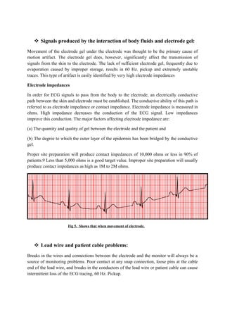 Signals produced by the interaction of body fluids and electrode gel:
Movement of the electrode gel under the electrode was thought to be the primary cause of
motion artifact. The electrode gel does, however, significantly affect the transmission of
signals from the skin to the electrode. The lack of sufficient electrode gel, frequently due to
evaporation caused by improper storage, results in 60 Hz. pickup and extremely unstable
traces. This type of artifact is easily identified by very high electrode impedances

Electrode impedances

In order for ECG signals to pass from the body to the electrode, an electrically conductive
path between the skin and electrode must be established. The conductive ability of this path is
referred to as electrode impedance or contact impedance. Electrode impedance is measured in
ohms. High impedance decreases the conduction of the ECG signal. Low impedances
improve this conduction. The major factors affecting electrode impedance are:

(a) The quantity and quality of gel between the electrode and the patient and

(b) The degree to which the outer layer of the epidermis has been bridged by the conductive
gel.

Proper site preparation will produce contact impedances of 10,000 ohms or less in 90% of
patients.9 Less than 5,000 ohms is a good target value. Improper site preparation will usually
produce contact impedances as high as 1M to 2M ohms.




                      Fig 5. Shows that when movement of electrode.




    Lead wire and patient cable problems:
Breaks in the wires and connections between the electrode and the monitor will always be a
source of monitoring problems. Poor contact at any snap connection, loose pins at the cable
end of the lead wire, and breaks in the conductors of the lead wire or patient cable can cause
intermittent loss of the ECG tracing, 60 Hz. Pickup.
 