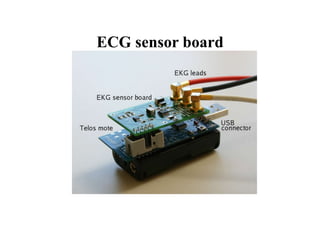 ECG sensor board
 