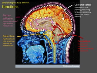 Credit:MarkLythgoe&ChloeHutton,WellcomeImages
different regions have different
functions
Cerebral cortex
Functions include:
planning; reasoning;
language; recognising
sounds and images;
memory.
Corpus
callosum
connects the brain’s
right and left
hemispheres
Cerebellum
important for
coordination,
precision and timing
of movement
Brain stem
regulates heart
rate, breathing,
sleep cycles
and emotions
 