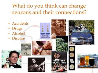 What do you think can change
neurons and their connections?
• Accidents
• Drugs
• Alcohol
• Disease
 