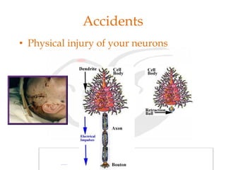 Accidents
• Physical injury of your neurons
 