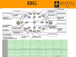 EEG
Wednesday, March 30,
2016
68
 