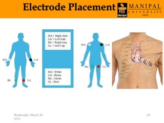 Electrode Placement
Wednesday, March 30,
2016
69
 
