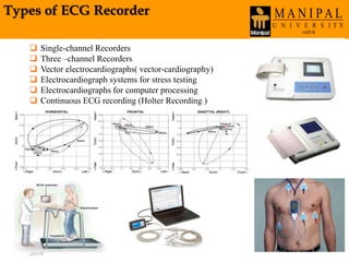 Types of ECG Recorder
Wednesday, March 30,
2016
72
 Single-channel Recorders
 Three –channel Recorders
 Vector electrocardiographs( vector-cardiography)
 Electrocardiograph systems for stress testing
 Electrocardiographs for computer processing
 Continuous ECG recording (Holter Recording )
 