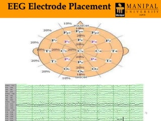 EEG Electrode Placement
Wednesday, March 30,
2016
78
 