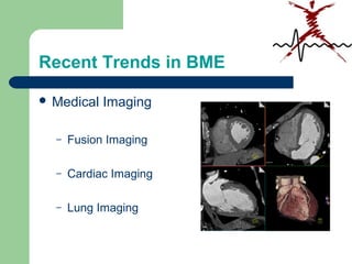 Recent Trends in BME
 Medical Imaging
– Fusion Imaging
– Cardiac Imaging
– Lung Imaging
 