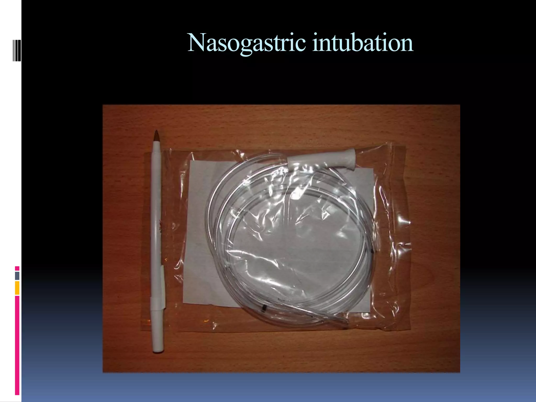 Nasogastric intubation
 