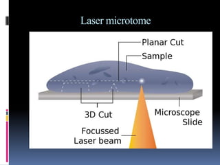 Laser microtome
 