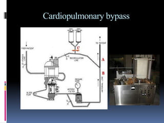 Cardiopulmonary bypass
 