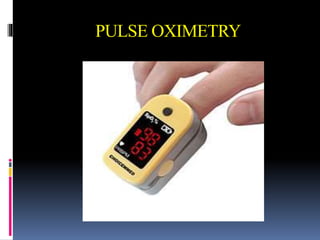 PULSE OXIMETRY
 