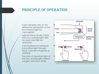 Biomedical_Instrumentation_Pulse_Oximetry_Illustrated (1)_٠٢٣٣١٣.pptx