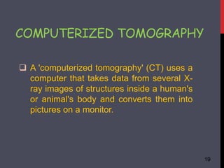 COMPUTERIZED TOMOGRAPHY
 A 'computerized tomography' (CT) uses a
computer that takes data from several X-
ray images of structures inside a human's
or animal's body and converts them into
pictures on a monitor.
19
 