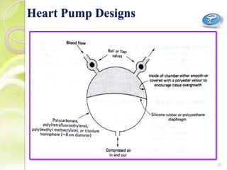 Heart Pump Designs
29
 