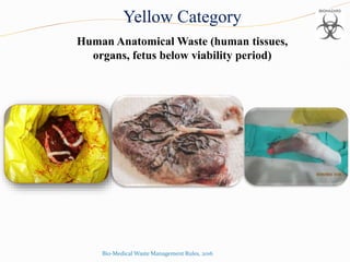 Yellow Category
Human Anatomical Waste (human tissues,
organs, fetus below viability period)
Bio-Medical Waste Management Rules, 2016
 