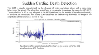 Sudden Cardiac Death Detection
The SCD is mainly characterized by the absence of peaks and drops along with a semi-linear
behavior of the signal. The algorithm tests if any given sample lies outside the range [- 0.15,0.15].
The threshold of ± .15 is very adequate to the SCD condition, as the absence of the electrical activity
of the heart on the second half of the ECG waveform has dramatically narrowed the range of the
amplitudes of the samples as shown in Fig.
Fig. Absence of the electrical activity of the heart on the second half of the ECG
waveform in the SCD Condition
 