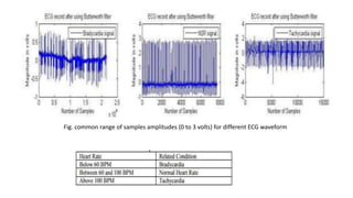 Fig. common range of samples amplitudes (0 to 3 volts) for different ECG waveform
 