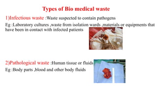 Types of Bio medical waste
1)Infectious waste :Waste suspected to contain pathogens
Eg :Laboratory cultures ,waste from isolation wards ,materials or equipments that
have been in contact with infected patients
2)Pathological waste :Human tissue or fluids
Eg :Body parts ,blood and other body fluids
 