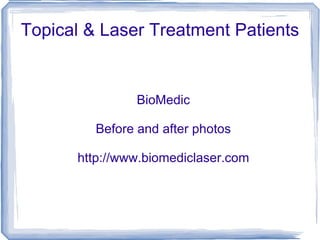 Topical & Laser Treatment Patients BioMedic Before and after photos http://www.biomediclaser.com 