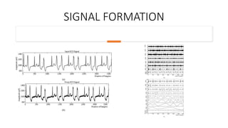 SIGNAL FORMATION
 