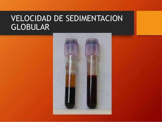 Biometría hemática completa
