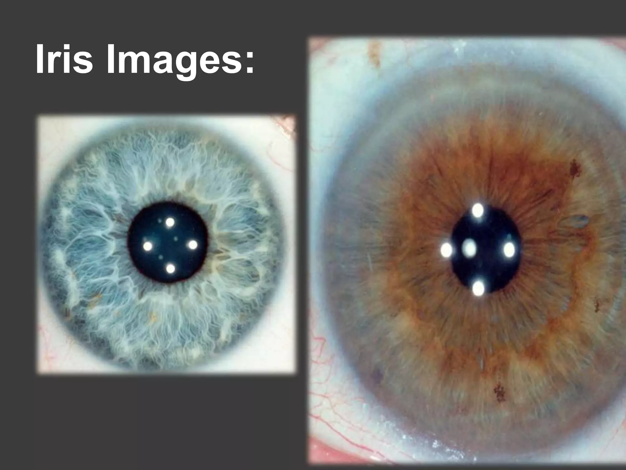 Iris Images:
 