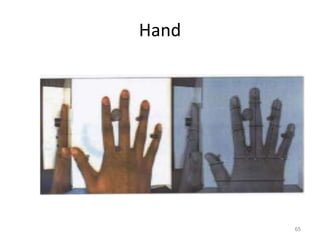Hand
65
 
