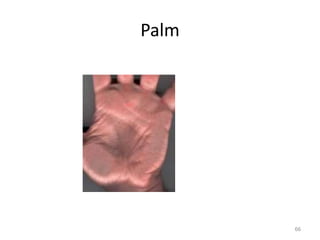 Palm
66
 