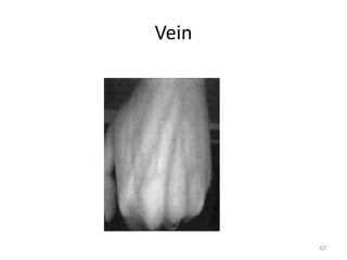 Vein
67
 
