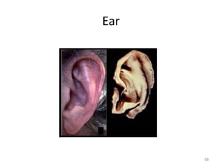 Ear
68
 