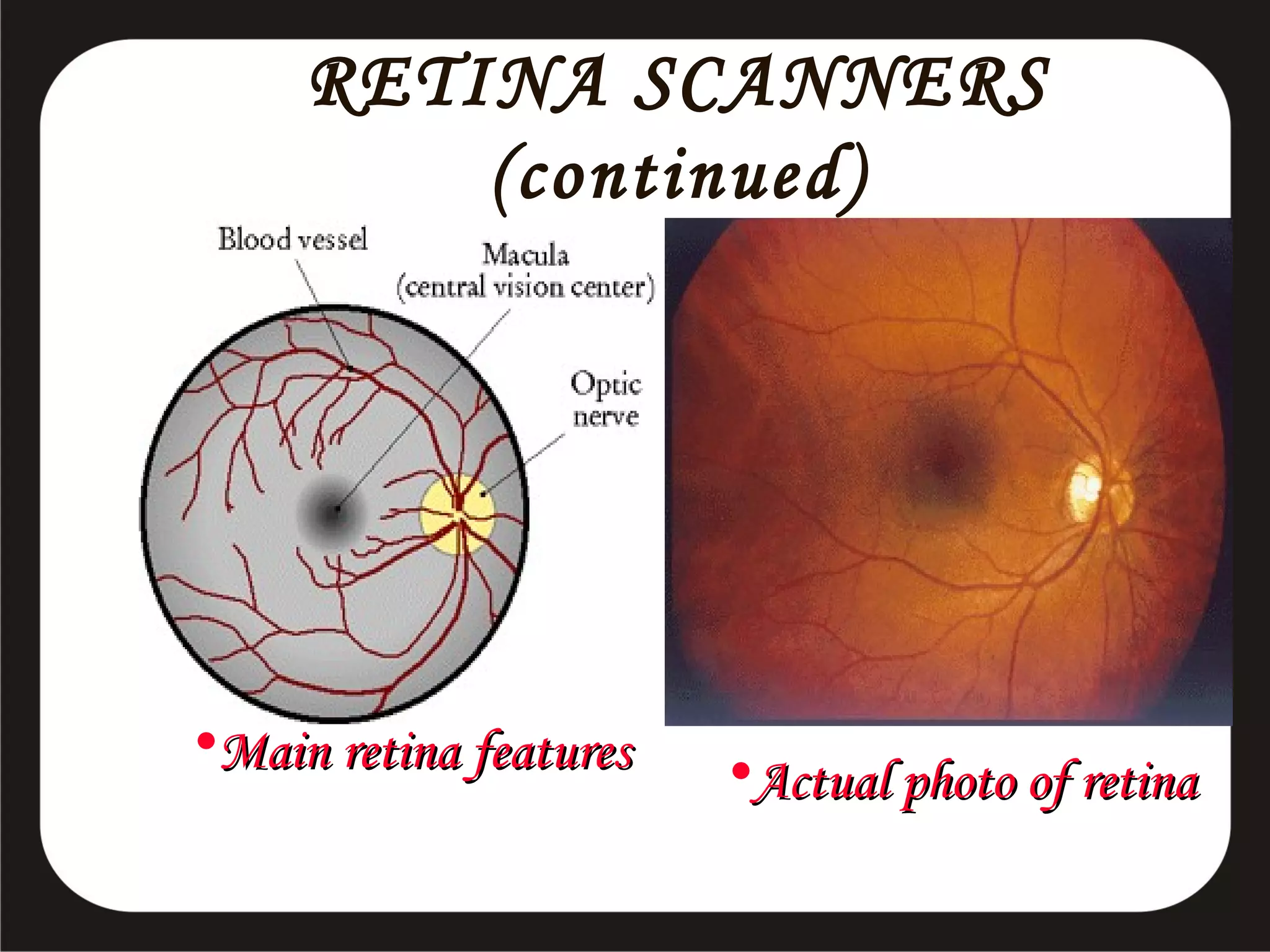 RETINA SCANNERS
(continued)

•Main retina features

•Actual photo of retina

 
